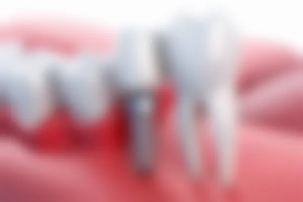 漳州博恩口腔医院地址及服务详解，2026年漳州看牙科医院推荐与排名信息分享