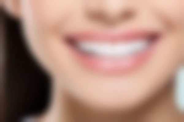 东莞佳悦口腔门诊牙痛治疗费用调整至350元起，原价为500元起。