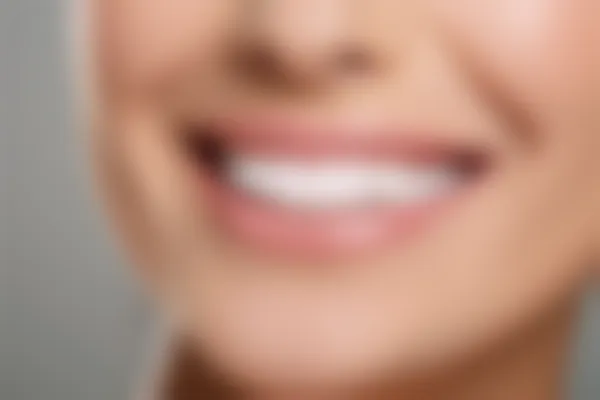 广州全家福口腔门诊部牙套价格仅需2500元起，原价3000元起，助您轻松拥有迷人笑容！