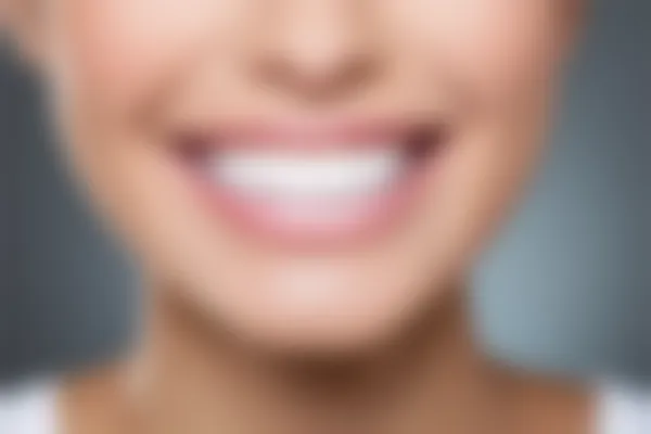 杭州朗宜口腔门诊部牙齿美白现价仅需1980元起，原价2980元起，尽享美白魅力，优异优惠不容错过！