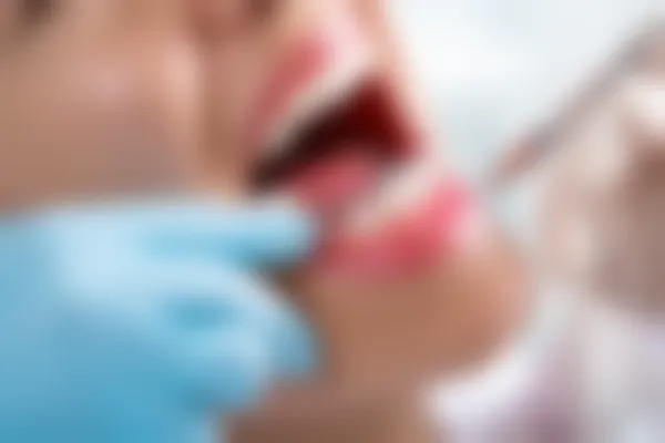 西安瑞泰口腔医院牙齿美白服务现价仅需1980元起，原价2980元起，限时优惠，抓紧机会！