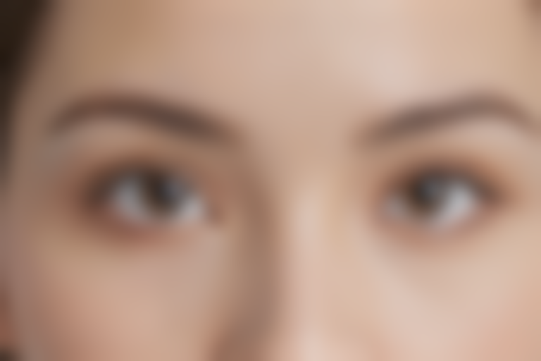 江苏泰州张勤眼科医院近视手术价格表:成人斜视手术价格10616元起