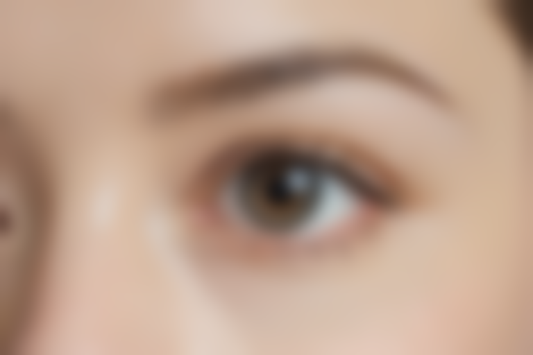 哈尔滨斯美诺医疗美容门诊部推出自体脂肪丰眼窝项目，现仅需7800元起，原价9800元起，尽享美丽新体验，优惠活动不容错过！