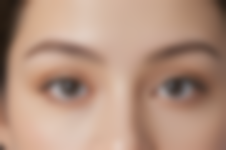 镇江瑞丽医疗美容医院自体脂肪全脸填充项目现仅需6000元起，原价8000元起，享超值优惠！