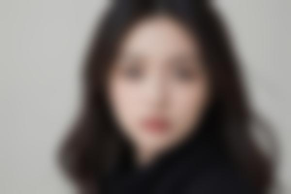 2、陈涛馒化修复让面部自然