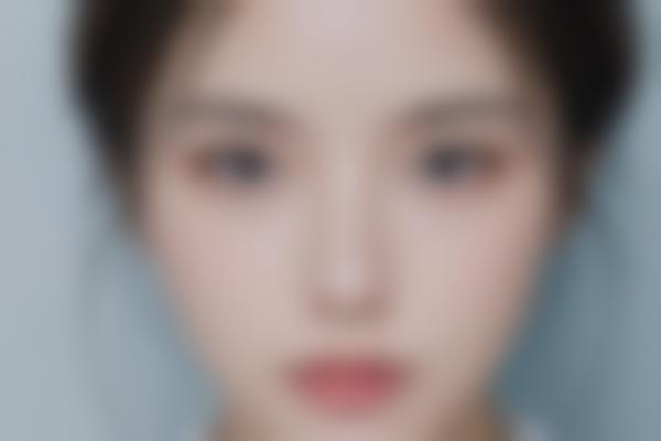 崔双全医生手术价格贵吗？