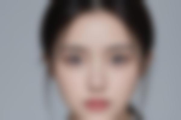 武汉医院曹玮医生整形修复,20年经验专注眼整形与面部年轻化