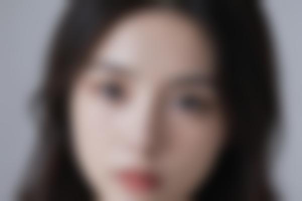 成都陶俊医生塑鼻20余年，10000+美鼻实例打造自然挺翘鼻型！