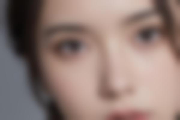 蒋思生鼻综合隆鼻自然