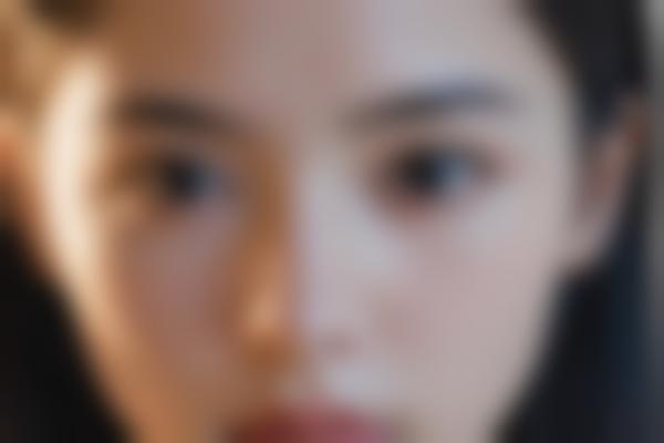 5、何晓娅术后指导细致入微