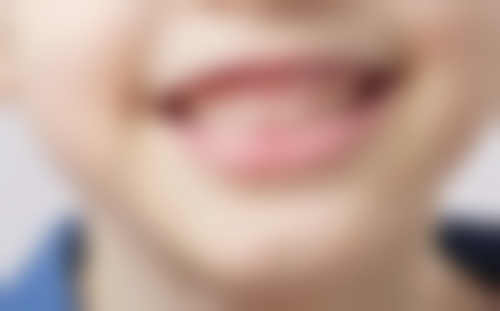 四、南通中诺口腔医院特色项目