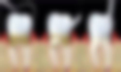 两个院区的对比与选择建议