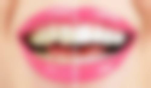 五、佛山利永均口腔门诊部收费价格表