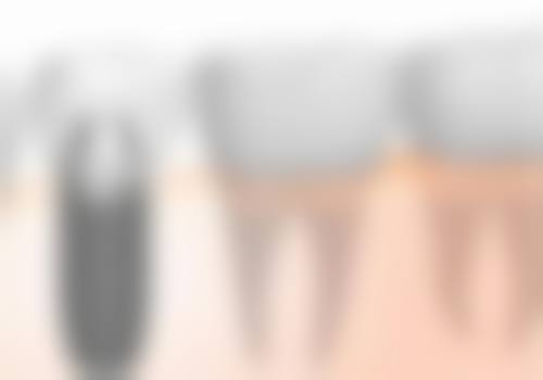 四、浙江温州永嘉陈呀芬口腔特色项目