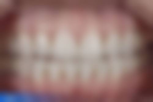 八、菏泽美尔口腔门诊部怎么预约？