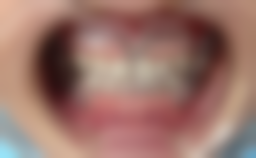 六、珠海拜博口腔阎璐医生口碑评价及真人实例反馈