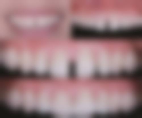 五、山东德州乐陵佳润口腔收费价格表