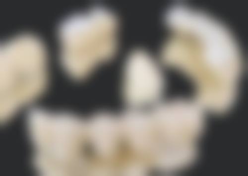 补牙用的黑色材料和白色材料哪个贵？通常白色材料更贵，原因及价格区间分析来了！ 