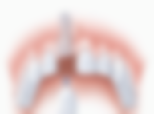 补牙时间和方案有哪些讲究？