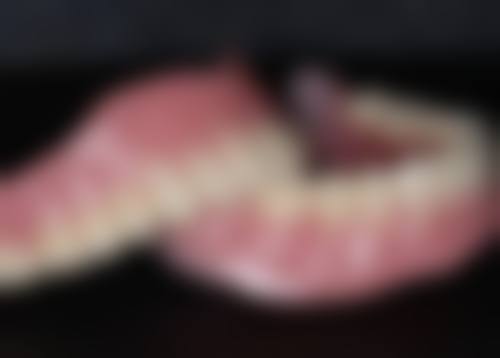 隐形牙和烤瓷牙哪个好？二者各有优劣，需结合自身牙齿状况与需求并咨询牙医来选择！ 