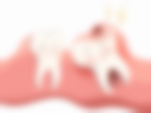 洗牙后会不会牙缝变大？实则多因去除异物、牙龈消肿等，正确洗牙不会致牙缝变大！ 