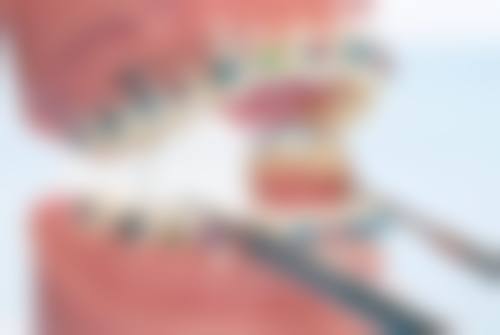 补牙可以矫正牙齿吗？多数情况可行，但受多种口腔状况影响，需检查后确定！ 