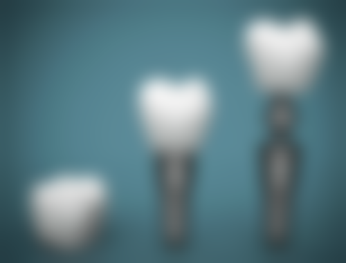 补牙齿的蓝光的安心性