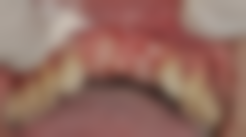 八、广东深圳艾雅洁口腔怎么预约？