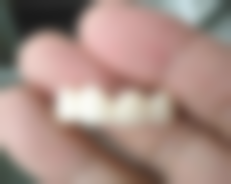 四、湖北孝感益美口腔特色项目