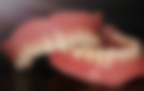 种植牙大概价位要多少？一般5000 - 30000元/颗，受品牌、材质、地区等因素影响！ 