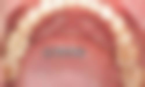 八、扬州牙管家口腔怎么预约?