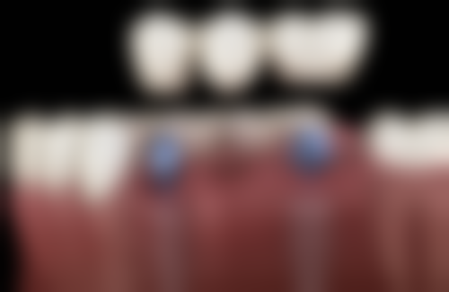 六、广东汕尾陆丰牙卫士口腔口碑如何?