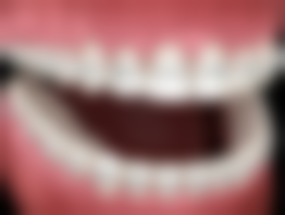 六、杭州闻喜淇杰口腔医院(余杭古墩路口腔诊所)口碑如何？