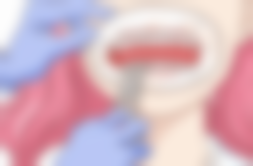 日常维护防止槟榔渍再生