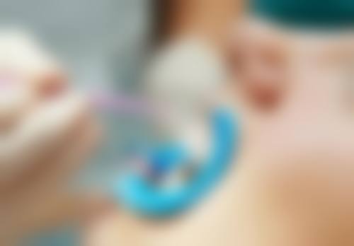 促进拔牙后伤口愈合的方法