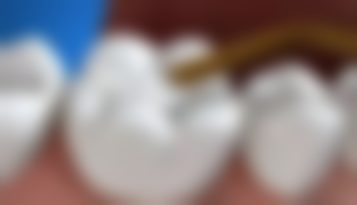 六、杭州滨江区冯国成口腔诊所口碑如何?