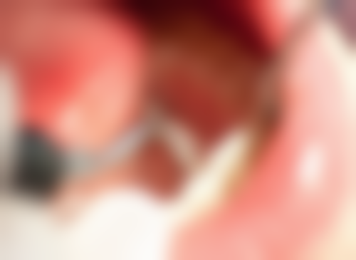 三、福建省莆田市荔城区任华口腔医生介绍