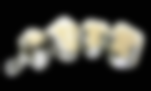 四、泉州晋江陈埭维尔正齿口腔诊所特色项目