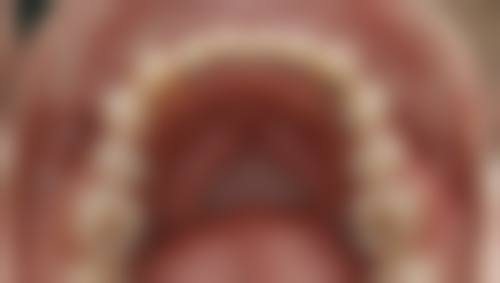 五、东莞长安芽博仕口腔诊所收费价格表