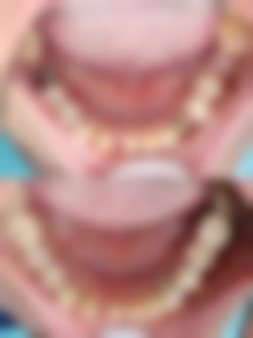 六、江苏苏州昆山健齿口腔口碑如何?