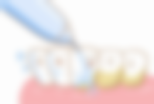 四、安徽铜陵雅嘉口腔特色项目