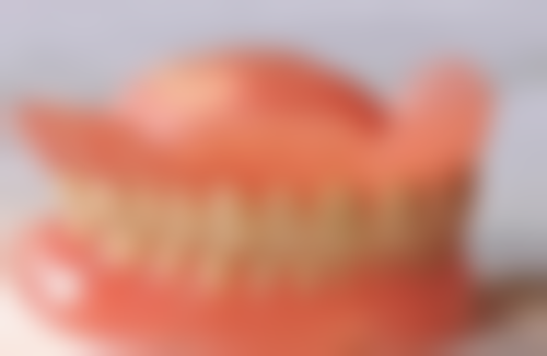 市场供需关系对贵金属烤瓷牙价格的影响