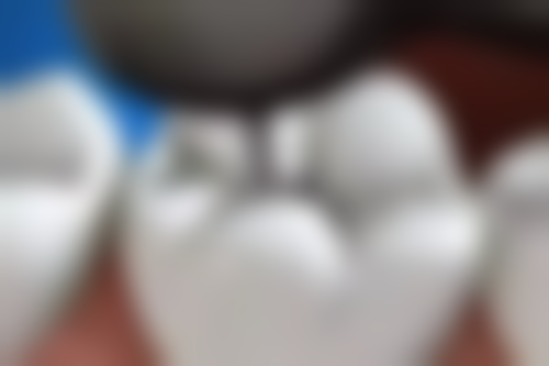 四、巴彦淖尔张锐锋口腔特色项目