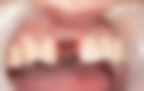 二、山东潍坊高新欣雅口腔正规吗？来看医院资质信息