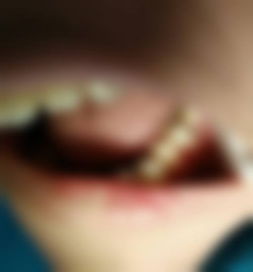 四、武威牙乐美口腔诊所特色项目