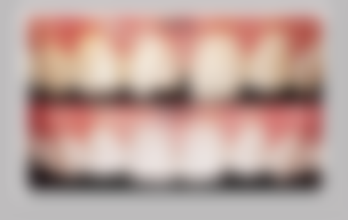 拔牙后的护理要点