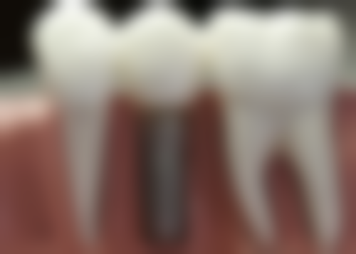 八、山东淄博鑫悦口腔怎么预约？