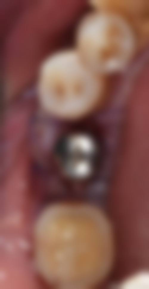 四、嘉兴宋双泉口腔特色项目