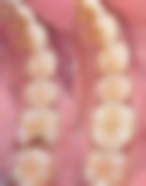 五、葫芦岛德诺口腔收费价格表