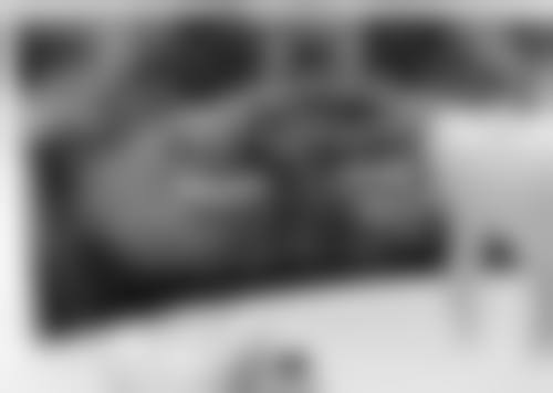 内源性黑色物质洗牙能否洗掉